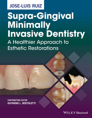 SUPRA-GINGIVAL MINIMALLY INVASIVE DENTISTRY - Ruiz