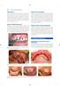 FUNDAMENTOS DE CIRUGIA ORAL Y MAXILOFACIAL - Pogrel / Andersson