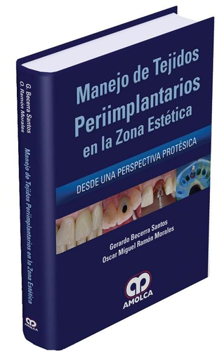 MANEJO DE TEJIDOS PERIIMPLANTARIOS EN LA ZONA ESTETICA - Becerra