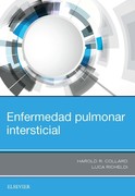 ENFERMEDAD PULMONAR INTERSTICIAL - Collard