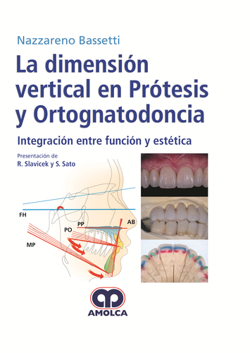 LA DIMENSION VERTICAL EN PROSTESIS Y ORTOGNATODONCIA. INTEGRACION ENTRE FUNCION Y ESTETICA - Bassetti