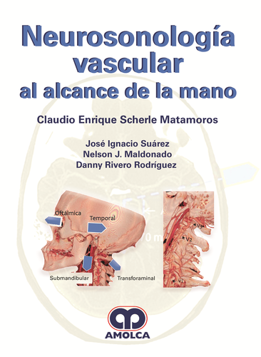 NEUROSONOLOGIA VASCULAR - Scherle