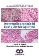 INTERPRETACION DE BIOPSIA DEL RIÑON Y GLANDULA SUPRARRENAL - Tickoo
