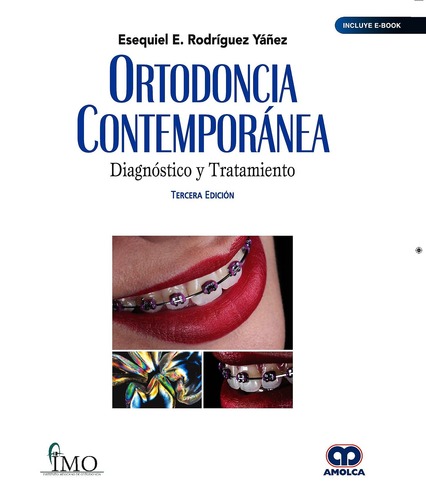 Ortodoncia Contemporánea Diagnóstico y Tratamiento (Incluye E-Book) - Esequiel Rodríguez