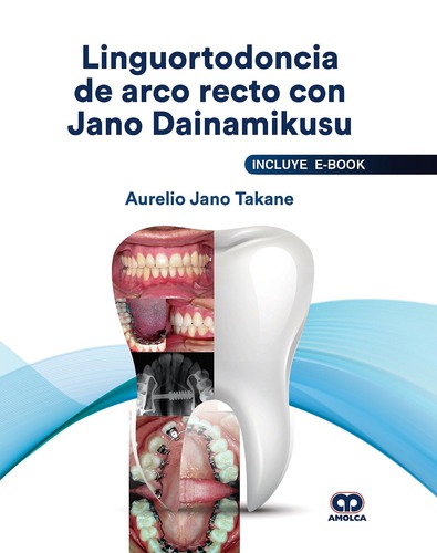 Linguortodoncia de Arco Recto con Jano Dainamikusu (Incluye E-Book) -  Aurelio Jano Takane