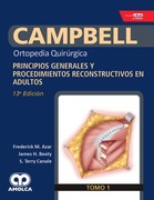 CAMPBELL Ortopedia Quirúrgica. Tomo 1: Principios Generales y Procedimientos Reconstructivos en Adultos - Azar / Beaty / Canale