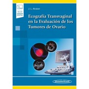 Ecografía Transvaginal en la Evaluación de los Tumores de Ovario (incluye versión digital) - Juan Luis Alcázar Zambrano