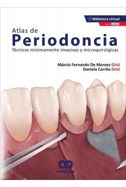 ATLAS DE PERIODONCIA Técnicas Mínimamente Invasivas y Microquirúrgicas - De Moraes Grisi