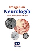 IMAGEN EN NEUROLOGIA- Osborn / B.Digre