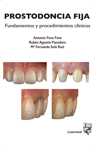 PROSTODONCIA FIJA. Fundamentos y procedimientos clínicos.- Antonio Fons, Rubén Agustín y Mª Fernanda Solá