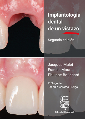 Implantología dental de un vistazo - Malet / Mora / Bouchard