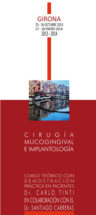 Cirugía Mucogingival e Implantología Dr. Carlo Tinti & Dr. Santiago Carreras 