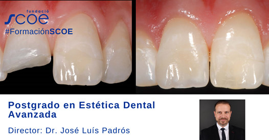 Postgrado en estetica dental