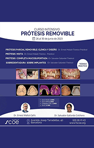 Curso Intensivo de Prótesis REMOVIBLE (parcial, completa y sobredentaduras sobre implantes) - Ernest Mallat & Salvador Gallardo
